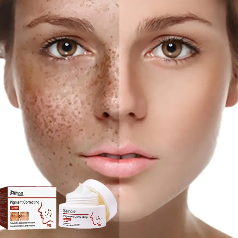 Crema correctora de pigmentos EELHOE, crema antipigmentación, crema de tratamiento de pigmentación de melasma para eliminar las manchas oscuras en la cara