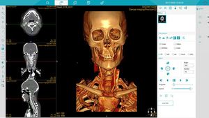 Medsinglong bilgisayar tomografi 32 dilim spektral görüntüleme 2D 3D CT tarayıcı CT makine - Product Image 6