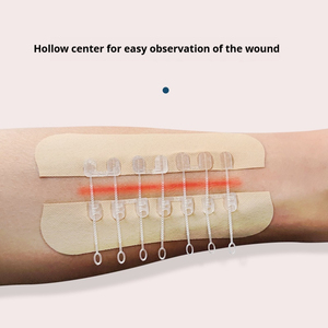 Strip penutup luka bekas luka Strip sterni-strip medis untuk penyembuhan pasca operasi dan jahitan ritsleting anak - Product Image 5