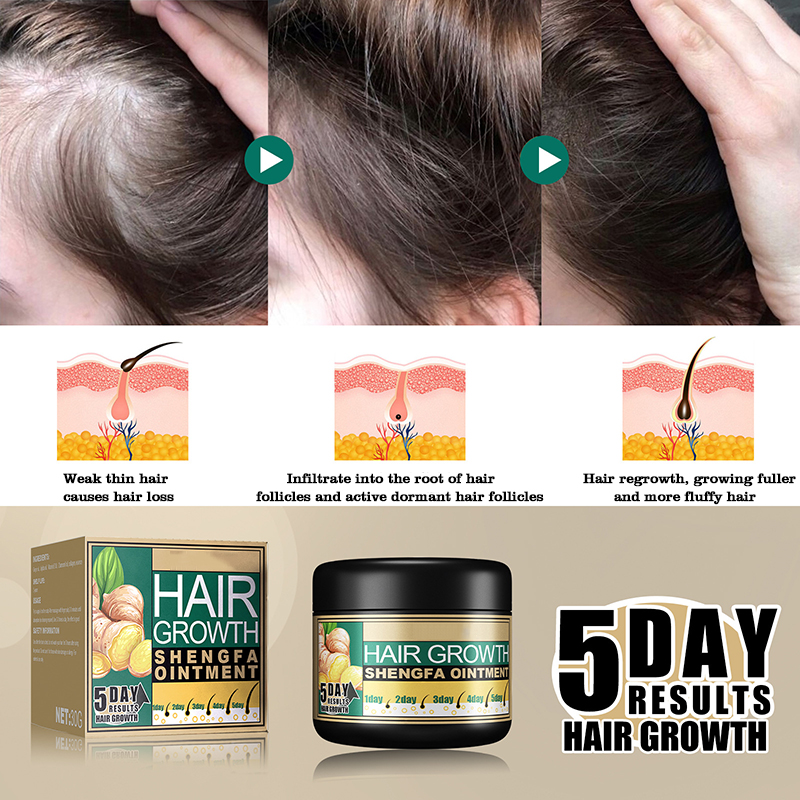 hot sale natural hair loss treatment solution 5 days ginger hair growth ointment 30g hair growth cream