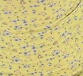 Z623DS01 Yellow