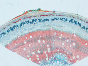 Fitologia Botânica Planta Microscópio Slide para a Ciência Médica Preparação