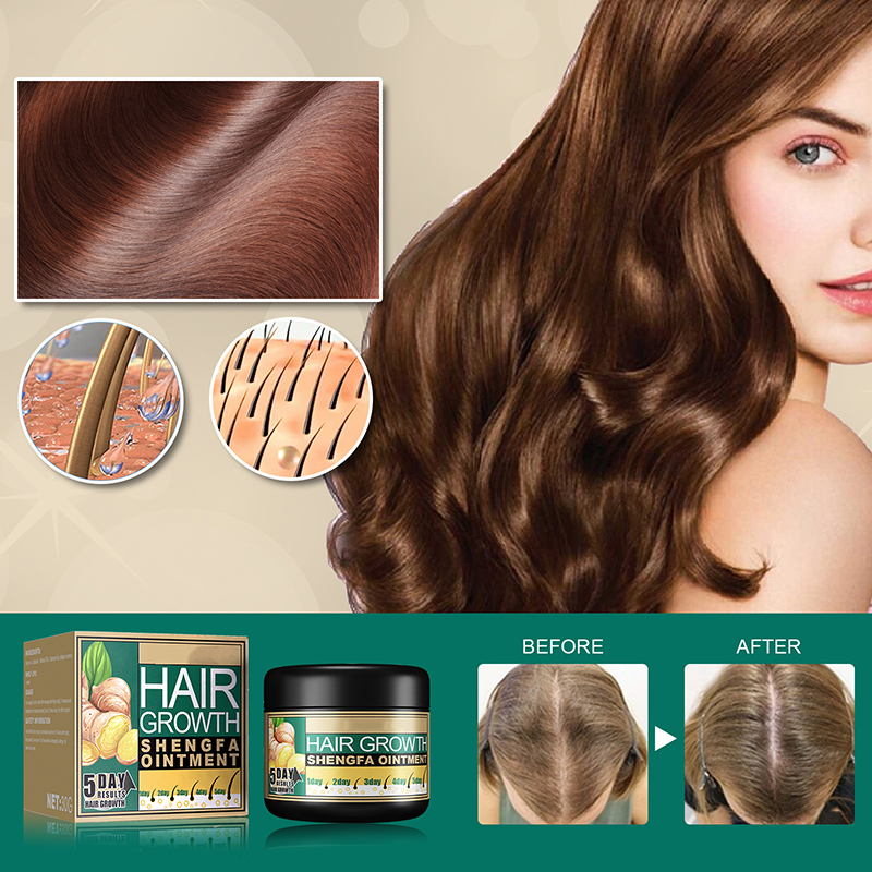 hot sale natural hair loss treatment solution 5 days ginger hair growth ointment 30g hair growth cream