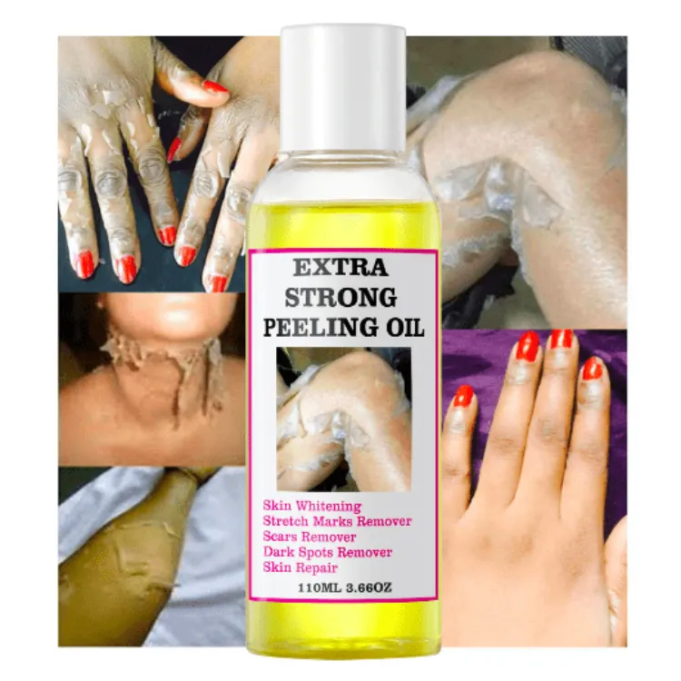 Aceite peeling de piel, marca privada, baja cantidad mínima de pedido, efecto increíble, eliminación de manchas