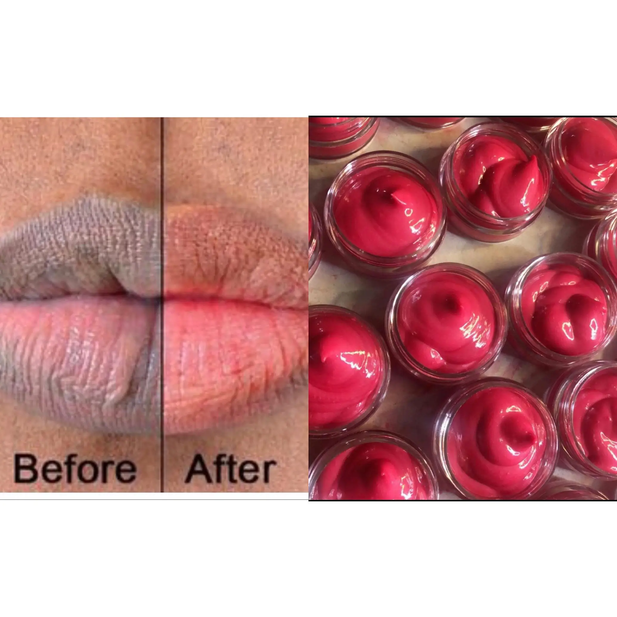 Natuurlijke Roze Llip Balsem Lippen Verlichtende Crème Lip Cream Voor Zwarte Lippen