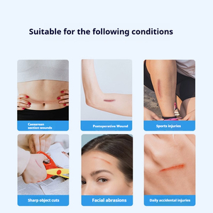 Strip penutup luka bekas luka Strip sterni-strip medis untuk penyembuhan pasca operasi dan jahitan ritsleting anak - Product Image 4