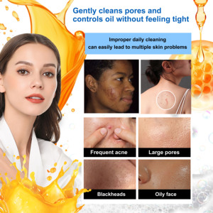 ROUSHUN VC <strong>Soap</strong> Bleaching Brightening Hand Bathing <strong>Soaps</strong> Vitamin C <strong>Soap</strong> - Product Image 4