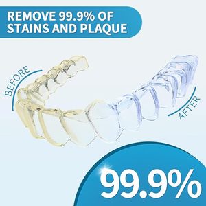 Nuovo Design kit per sbiancamento denti 120 pezzi pastiglie per la pulizia della protesi per protesi - Product Image 3