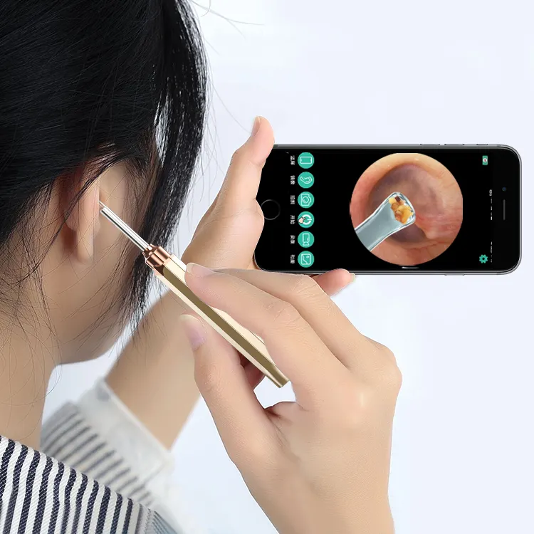 Herramienta de extracción de cera de oídos, otoscopio de limpieza de oídos con Wifi, médico integrado, seguro, removedor de cera de oídos eléctrico, 2023