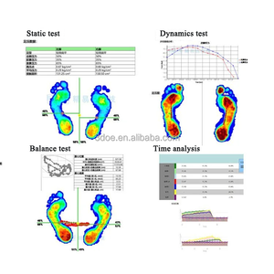 GaitMaster UltraTech MaxPrime: umfassende Fußdruck-Analyse-Lösung für Leistungsoptimierungsinstitute - Product Image 6