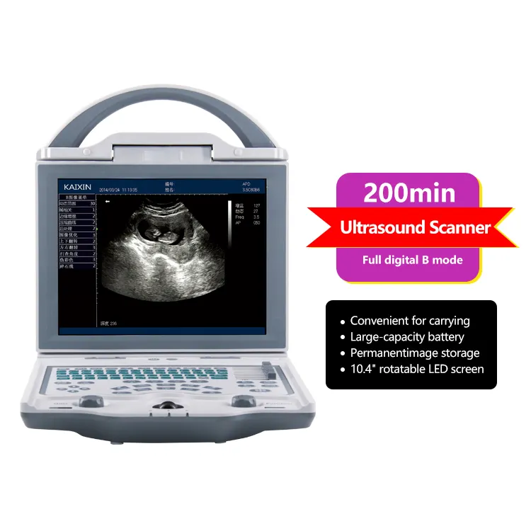 Mesin Ultrasound pemindai genggam, diagnosis perangkat genggam Ultrasound portabel 3D 4D pencitraan sonosape