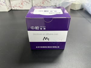 Örneklerde IAC217 Aflatoxin fumonitoxin zearalenone 3-1affinity sütun Aflatoxin, fumonitoxin ve zearalenone tespit edildi - Product Image 5