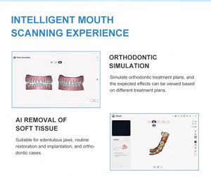 OScan Smart Alta Qualidade Portátil 3d <span class=keywords><strong>Dental</strong></span> Intraoral Camer para Clínica Dentária Velocidade de Digitalização Mais Rápida - Product Image 6