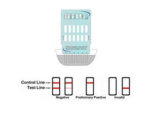 Clinical Laboratory Drug <strong>Testing</strong> Medical Lab test Equipment, Drug Screening Lab test