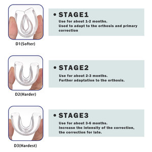 QTMG-001B Zahnspangen für Zahn ausrichtung & Anti-Schnarch-Gerät & Schnarch Mundstück, Zahn ausrichtung Zahnspangen Mundschutz - Product Image 5