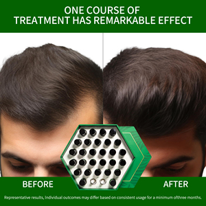 OEM Professional Factory Manufacture 5Ml * 28 Bottles Fast Hair Growth <strong>Oil</strong> for <strong>Black</strong> Women