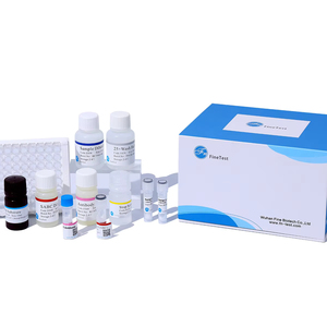 FineTest Rat ctn-i/TNNI3 ELISA seti bilimsel araştırma kardiyak Troponin test kiti hızlı test kimyasal reaktifler - Product Image 1