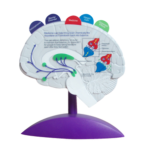 Epilepsi modeli İnsan beyin patoloji modeli anatomik eczane hediye - Product Image 1