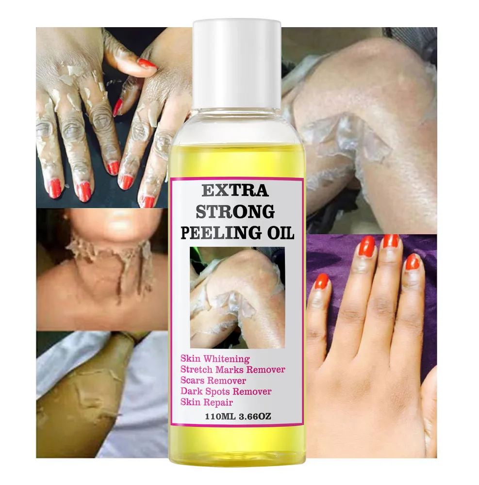 Private Label Extra Sterke Peeling Olie Topkwaliteit Voor Gezicht En Lichaam Gele Peeling Lotion Voor Donkere Knokkel En Littekens Bleken