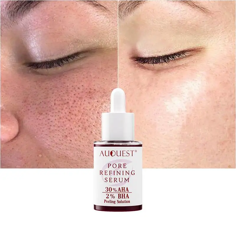 Pore Refining Serum 30% AHA 2% BHA Peeling-Lösung Schrumpfen Poren beseitigt Pickel verringern Pickel Marks Essenz