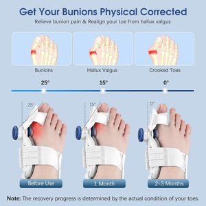 Korektor Bunion yang dapat disesuaikan untuk wanita & pelurus jari kaki & pelindung nyeri, koreksi Hallux <span class=keywords><strong>Valgus</strong></span> (putih) - Product Image 2