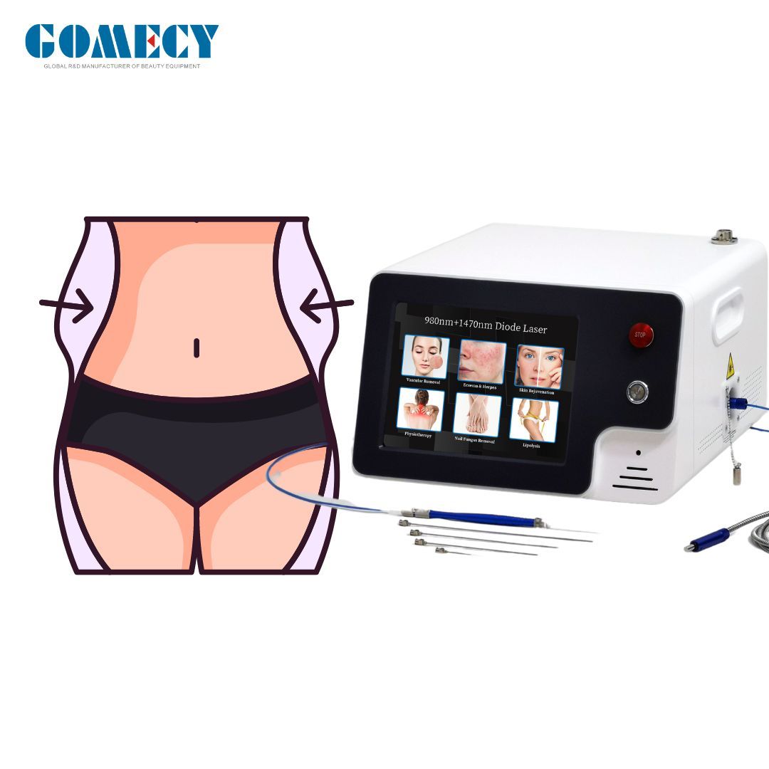 Lipolysis