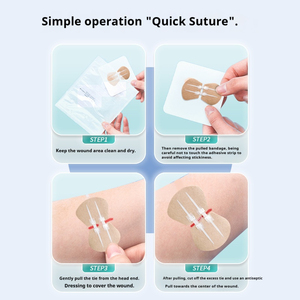 Strip penutup luka bekas luka Strip sterni-strip medis untuk penyembuhan pasca operasi dan jahitan ritsleting anak - Product Image 3