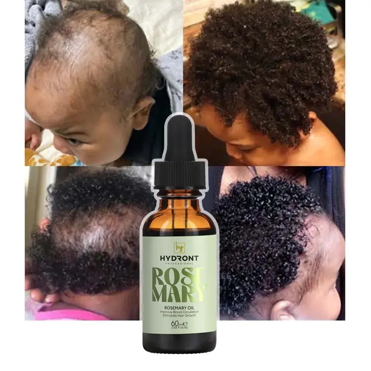 Produtos de perda de cabelo de efeito rápido com óleo de alecrim puro 100% natural Kooswalla para mulheres e homens negros de marca própria