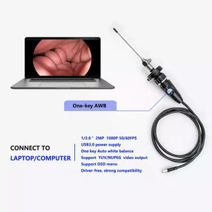TUYOU Mini Full HD ENT медицинское оборудование эндоскопическая камера система USB Connect с компьютером ноутбук - Product Image 5