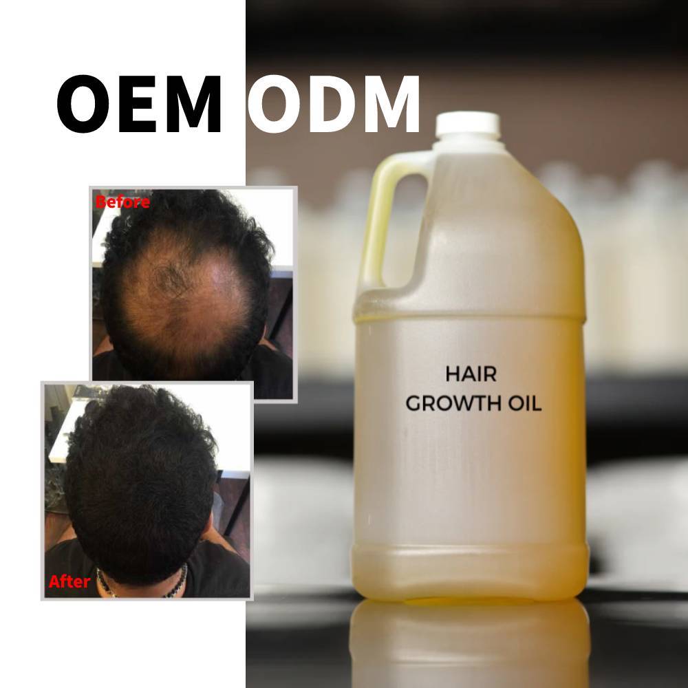 Hair regrowth oil 09