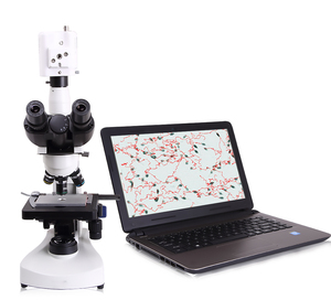 Analyse de sperme vétérinaire Sy-B178V Analyseur de qualité de sperme de chien Analyseur de sperme d'instrument - Product Image 2