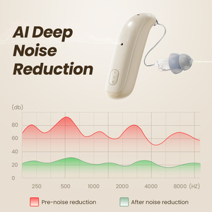 Mini <strong>Adaptive</strong> Scenario Sound Amplifier Programmable Low Latency RIC Hearing Aid Mild Profound Enhances Speech Ear <strong>Device</strong> - Product Image 2