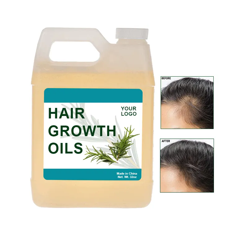 Galon Curah Perawatan Rambut Organik Minyak Pertumbuhan Minyak Rosemary Minyak Pertumbuhan Rambut untuk WANITA HITAM Label Pribadi