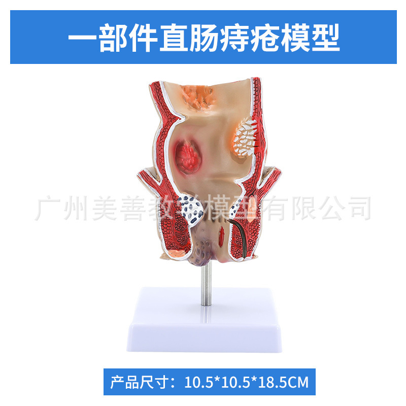 Pathology of rectal hemorrhoids - Part 1