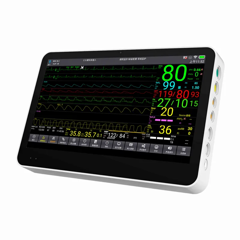 CONTEC CMS8500 serviço local paciente monitor multi parâmetro paciente monitor