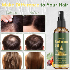 Biberiye kaybı doğal bitkisel sürdürülebilir onarım Serum çay ağacı artırılması Serum büyüme saç tedavisi saç yağı Batana yağı