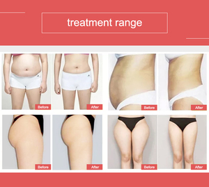 เครื่องโรลเลอร์สุญญากาศแบบ2ใน1 8d,เครื่องลดไขมันในลูกกลิ้งลูก8 D แบบไม่รุกราน - Product Image 6