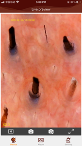Polarizer Dermatoscope Trichoscope Hair Scope Real 2MP HD fro iOS Android WiFi <span class=keywords><strong>Microscope</strong></span> with Replaceable Nozzles - Product Image 6