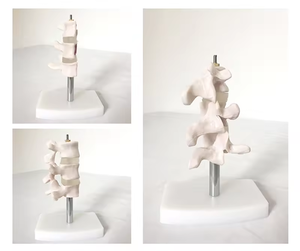 SCIEDU 2 Teile Osteoporose Läsion modell Wirbelsäulen-und Zervix dissektion gelenk modell Menschliche Anatomie Lendenwirbel modell - Product Image 6