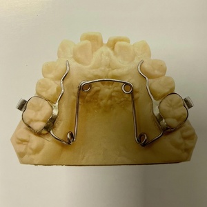 Avvolgente apparecchio ortopedico avvolgente per bambini modelli di denti ortodontici dentali avvolgenti - Product Image 2