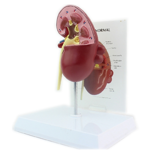 Medical Teaching Urinary System Model Human Anatomy Kidney Model Kidney Diseased Model