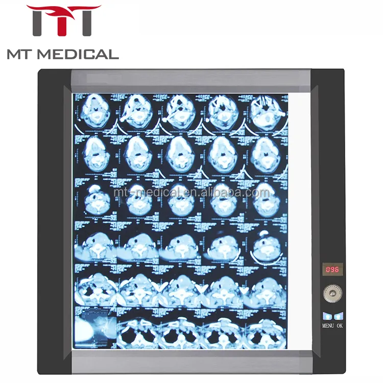 MT medis LED medis x-ray, penampil Film sinar X satu sisi penglihatan Film sinar X