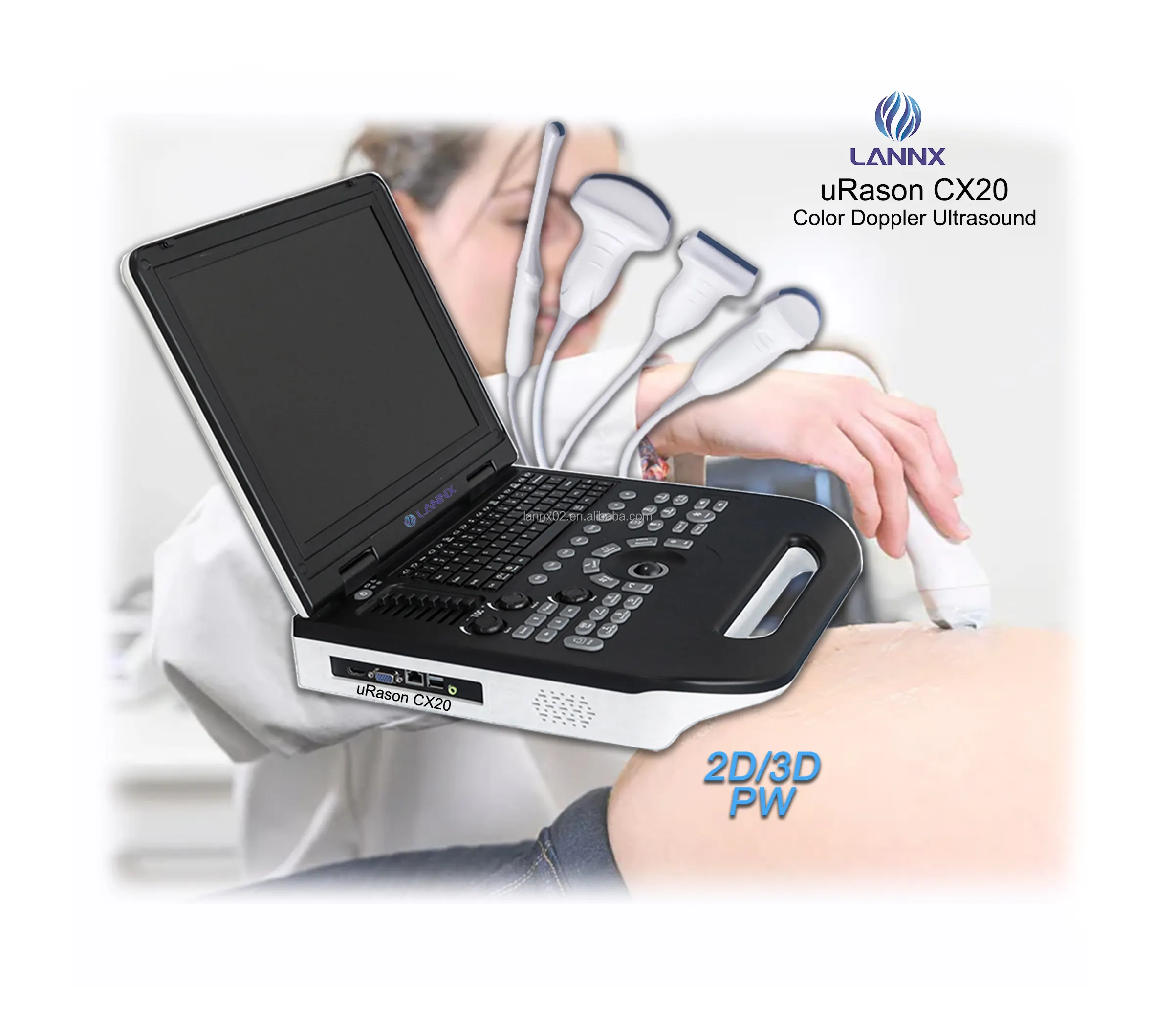 LANNX uRason CX20 envío rápido aplicación médica diagnóstico ultrasónico 128 permanentes PW color doppler máquina de ultrasonido