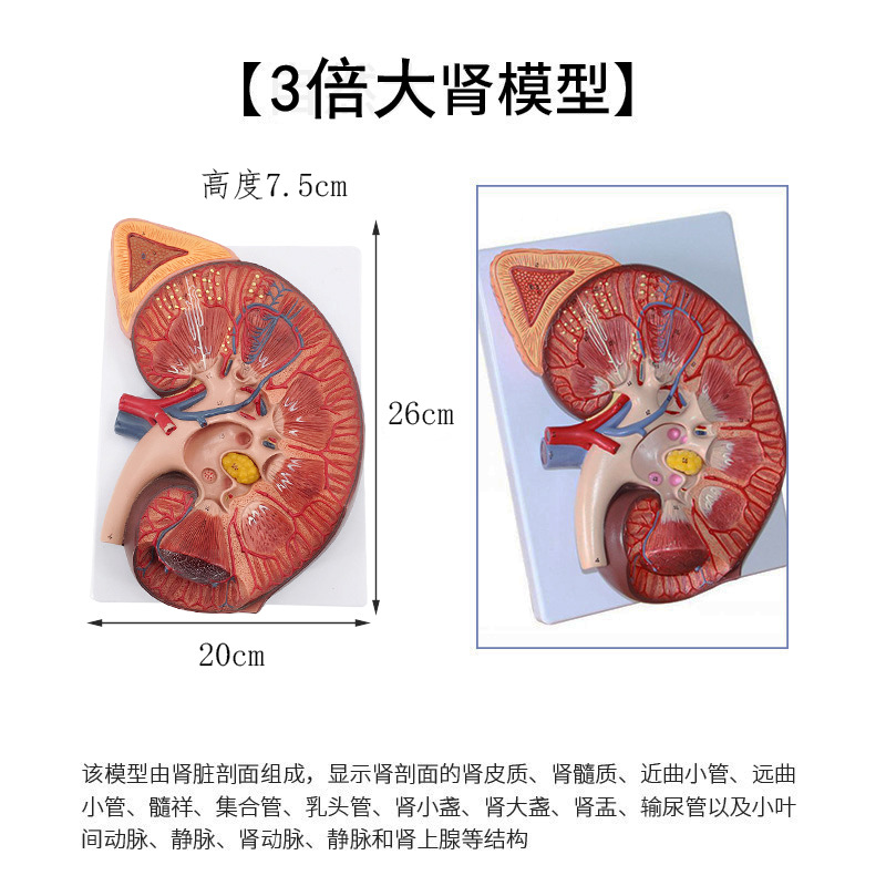 Modelo de anatomía renal con aumento de 3x