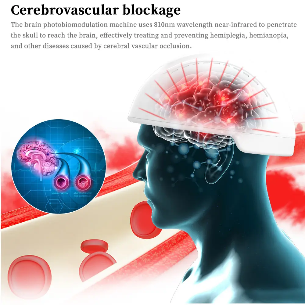 Suyzeko xuyên sọ từ não kích thích 810nm hồng ngoại phục hồi chức năng tpbm photobiomodulation Mũ bảo hiểm