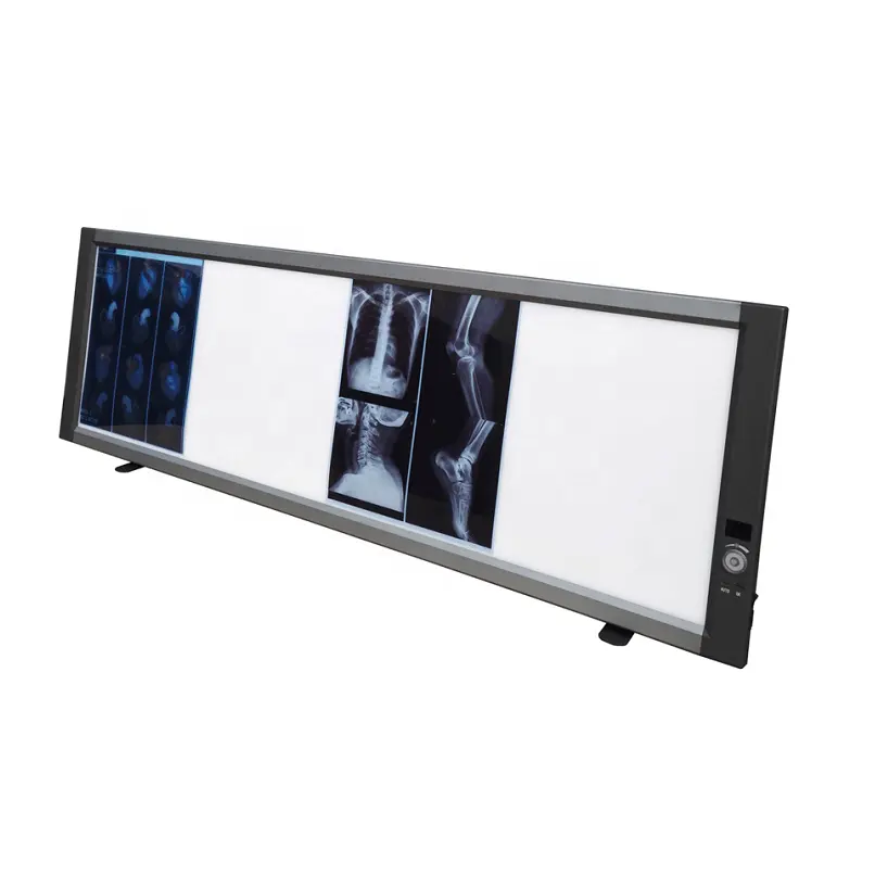 Medical X-ray Film Viewer Customized X-ray Film Viewer Box Medical View Box Led Negatoscope