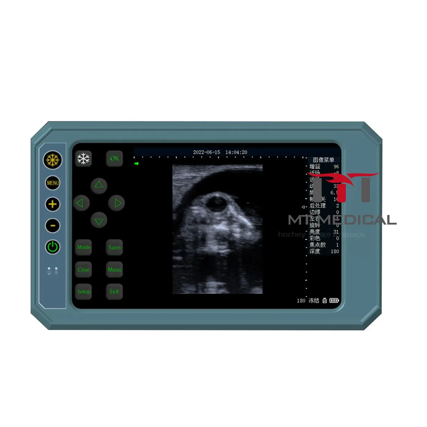 MT เครื่องอัลตราซาวนด์สัตวแพทย์แบบพกพาทางการแพทย์สัตว์แมวสุนัขเครื่องอัลตราซาวนด์แบบพกพา