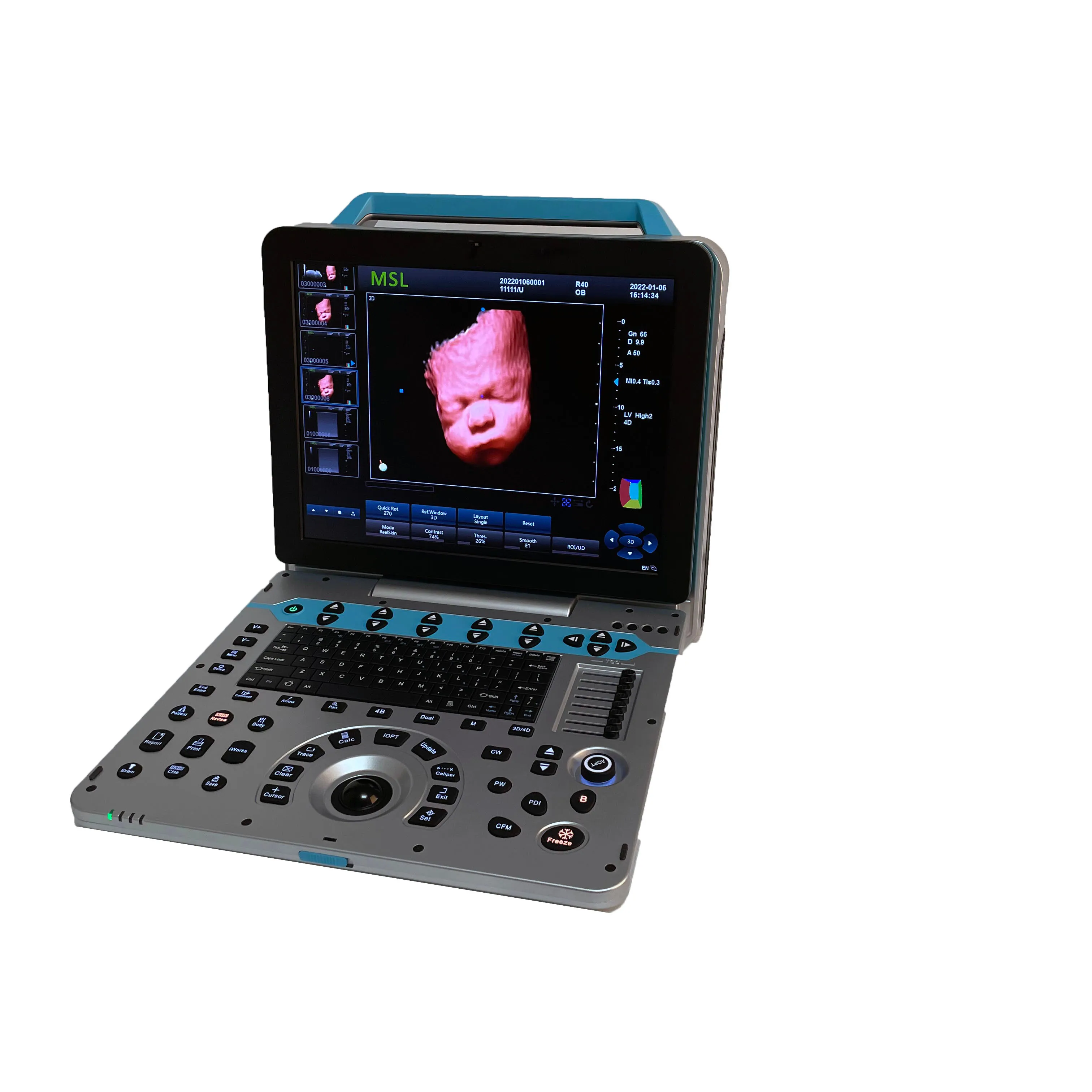 Carrello ad ultrasuoni portatile equipo de ultrasonido portatil usg 4d ecografo portatil echography doppler color 3D 4D