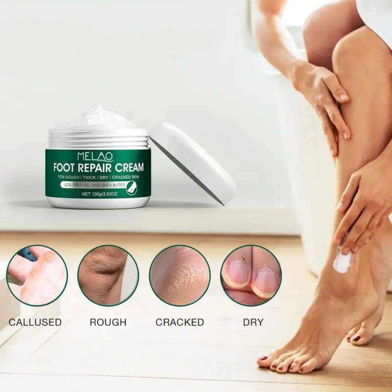 Callus Remover Gel Foot Repair Cream Fast Relief For Dry, Cracked, Itchy Feet And Heels