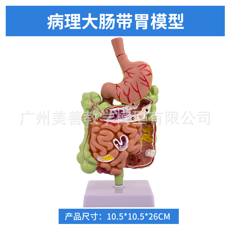 Large intestine with stomach (size 12)